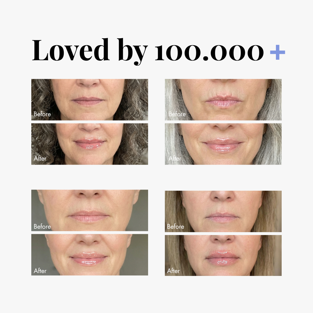 Triple Lip Plumper Bundle