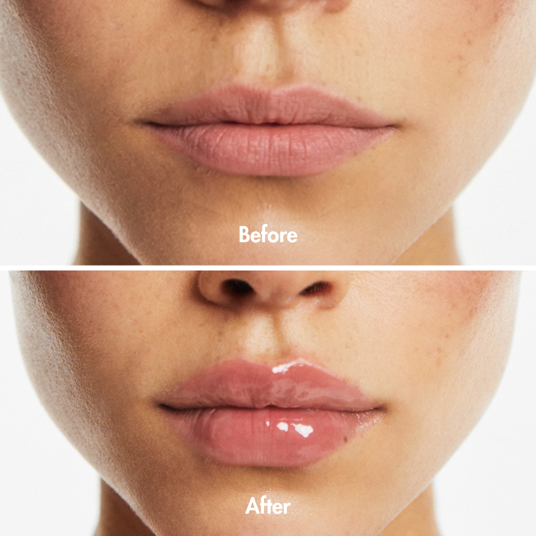 Extreme Lip Plumper