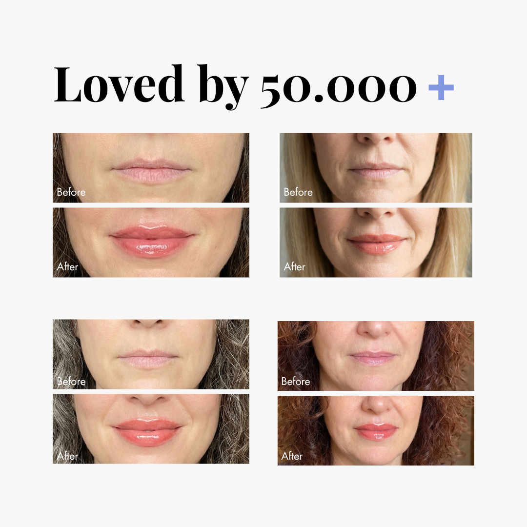 Extreme Lip Plumper