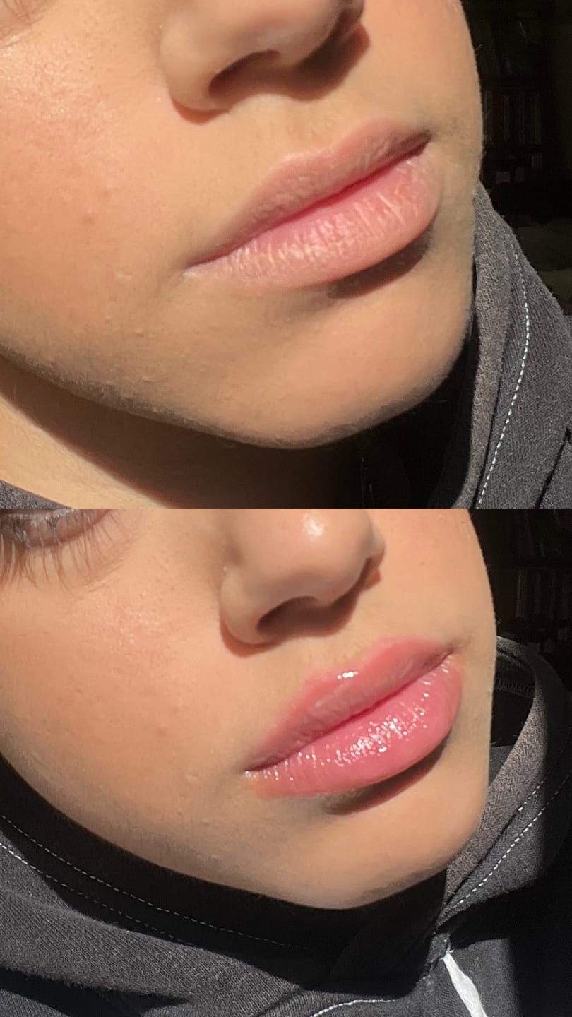 Customer photo review of Long Lasting Lip Plumper
