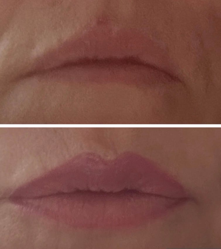 Customer photo review of Extreme Lip Plumper