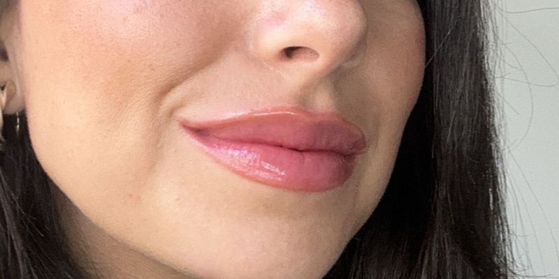 Melissa